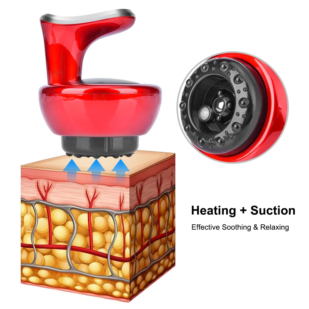 Electric Cupping Therapy Massage Scraping Physiotherapy Medical Chinese Gua Sha Anti Cellulite Suction Weight Loss Vacuum Cans